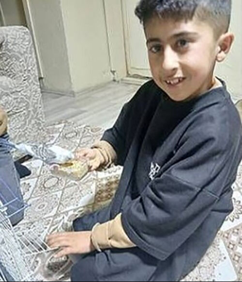 Sokak köpekleri çocuğunun yüzünü parçaladı! Acılı babanın feryadı yürek yaktı Sokak köpekleri çocuğunun yüzünü parçaladı! Acılı babanın feryadı yürek yaktı - 3. Resim