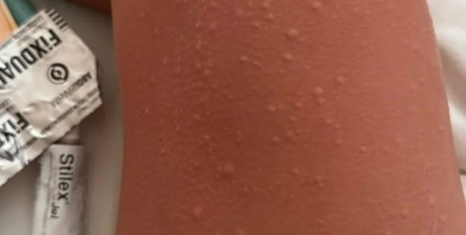 Ünlü şarkıcı Melek Mosso'dan korkutan haber! Bali'de hastanelik oldu Ünlü şarkıcı Melek Mosso'dan korkutan haber! Bali'de hastanelik oldu - 3. Resim