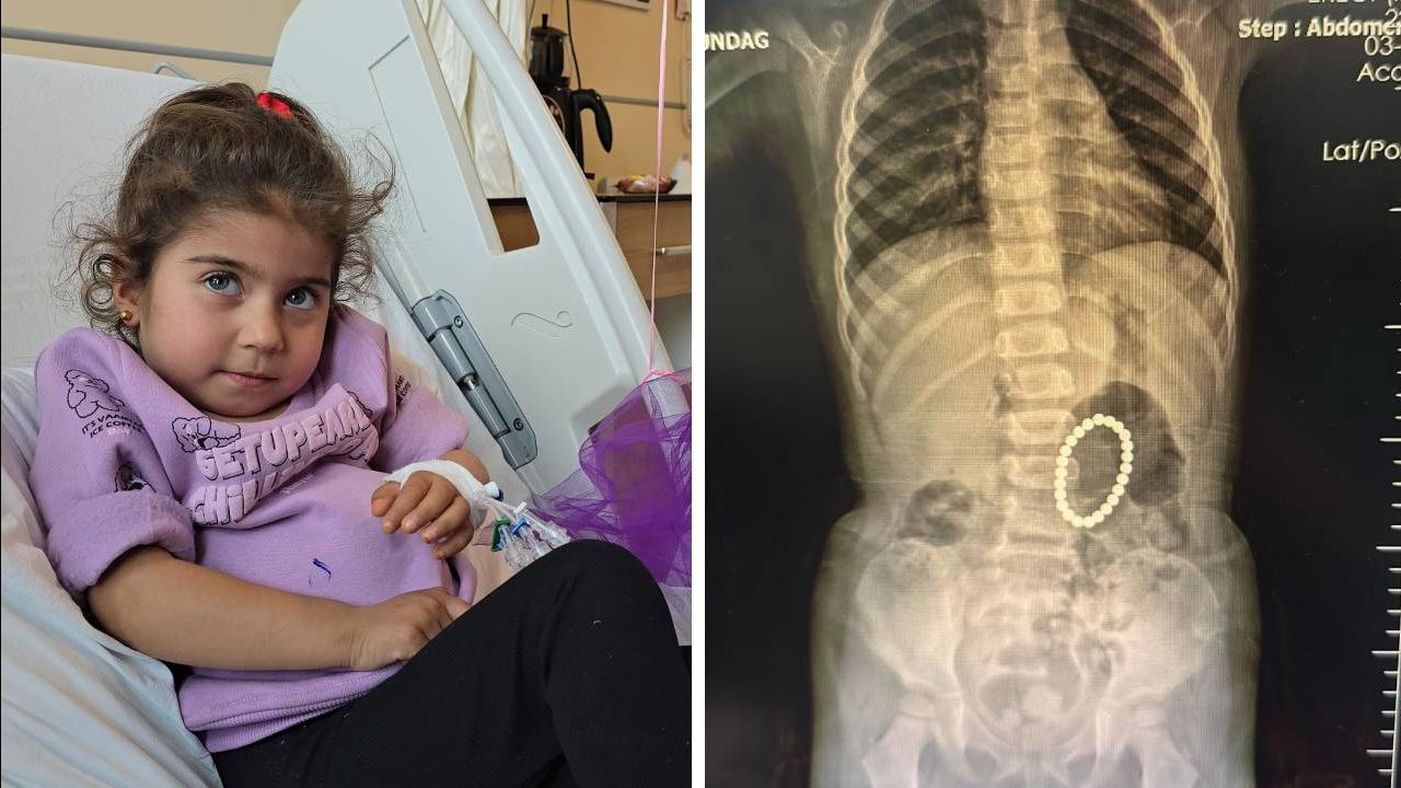 Karın ağrısı şikayetiyle gitti! Çocuğun midesinden çıkanlar doktorları bile hayrete düşürdü Karın ağrısı şikayetiyle gitti! Çocuğun midesinden çıkanlar doktorları bile hayrete düşürdü