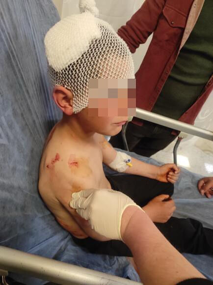 &Ouml;l&uuml;mden son anda kurtarıldı! Sokakta oynayan &ccedil;ocuğa başıboş k&ouml;pek saldırdı - 1. Resim