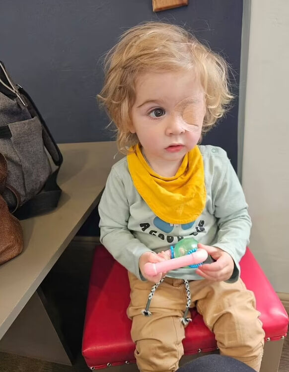 2 yaşındaki çocuk faciayı yaşadı! Bir öpücükle gözünden oldu - 3. Resim