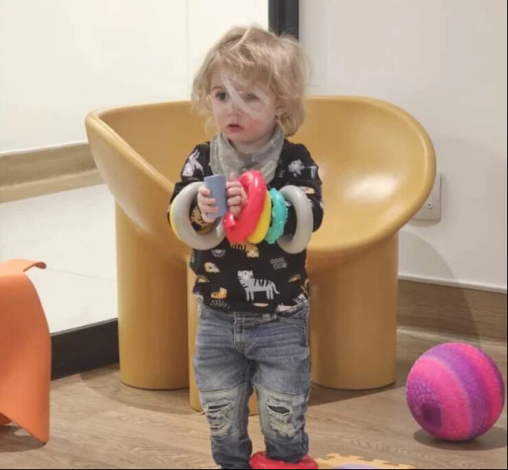 2 yaşındaki çocuk faciayı yaşadı! Bir öpücükle gözünden oldu - 1. Resim