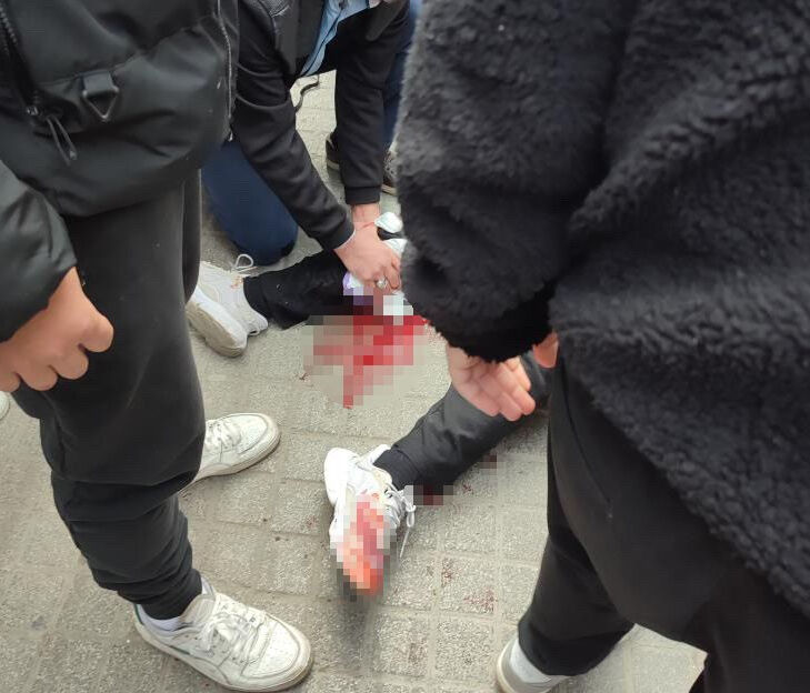 Broşür dağıtıyordu! Sokak ortasında ablasının eski sevgilisi tarafından vuruldu - 1. Resim