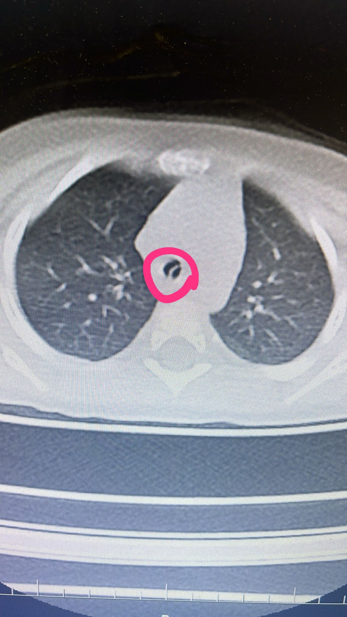 Heimlich Manevrası da çare olmadı! 9 aylık Merve'nin boğazına bıçak gibi saplandı - 3. Resim