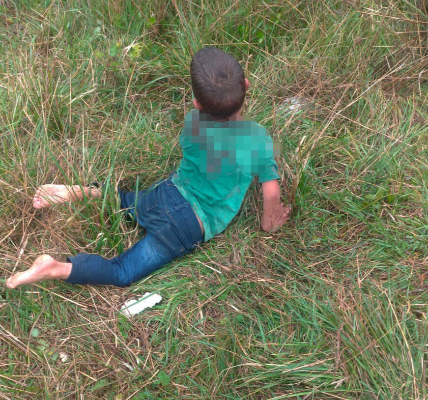 Yalova'da dehşet! Sokak köpekleri küçücük çocuğa saldırdı, görüntüler korkunç - 2. Resim