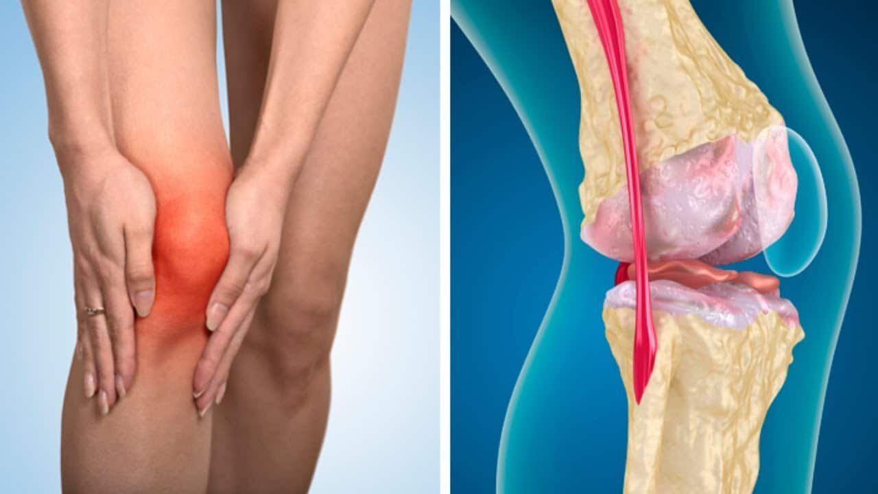 Kemiklerin fısıltısı: Artrozun (Eklem kireçlenmesi) sessiz saldırısı! - 1. Resim