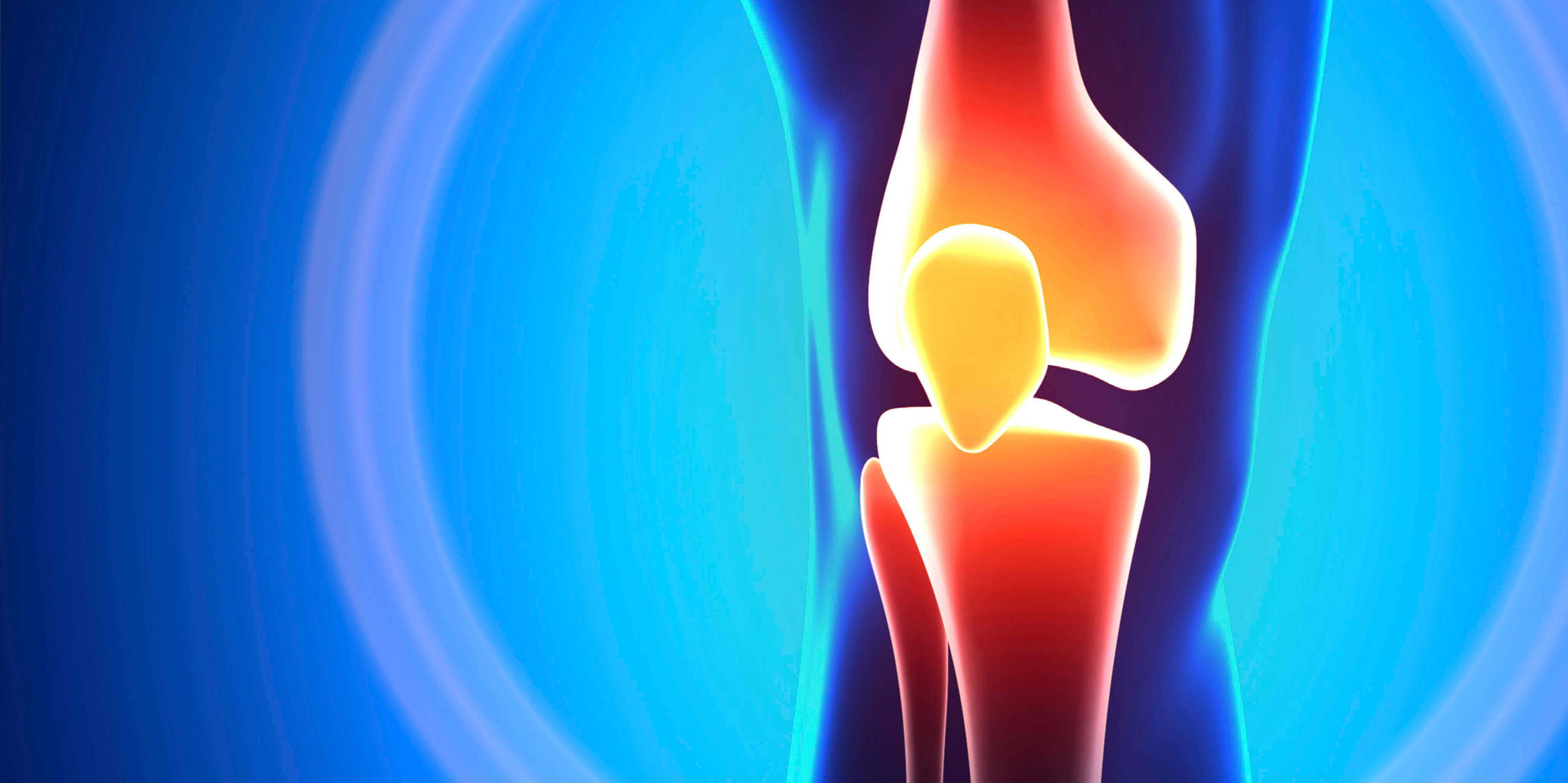 Kemiklerin fısıltısı: Artrozun (Eklem kireçlenmesi) sessiz saldırısı! - 3. Resim