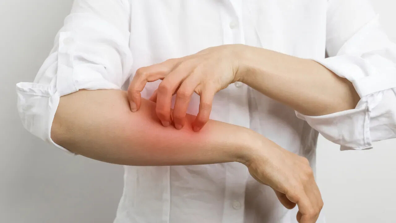 Öksürük, hapşırık, kaşıntı: Alerjiler hayatımızı nasıl etkiliyor? - 1. Resim