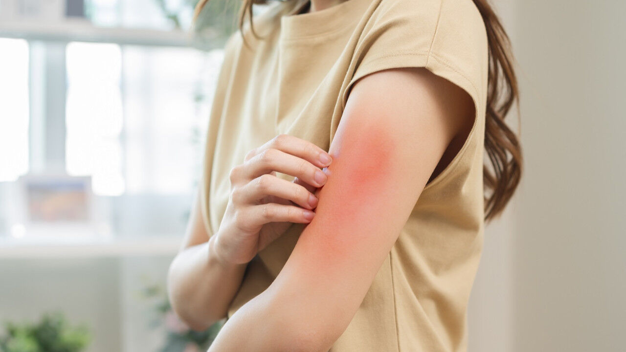 Öksürük, hapşırık, kaşıntı: Alerjiler hayatımızı nasıl etkiliyor? - 2. Resim