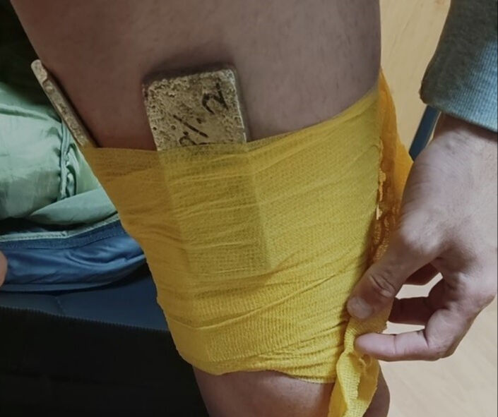 6 milyon euro değerinde! Vücuduna sarıp Türkiye'ye sokmak isterken yakalandı - 2. Resim