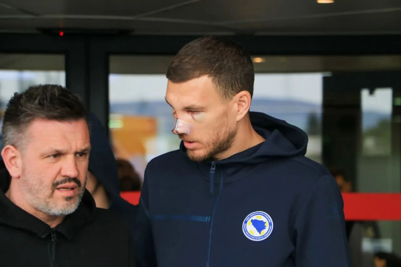 Dzeko'dan üzen haber! Burnu kırıldı, gözleri morardı… İstanbul’a dönüş tarihi belli oldu - 1. Resim