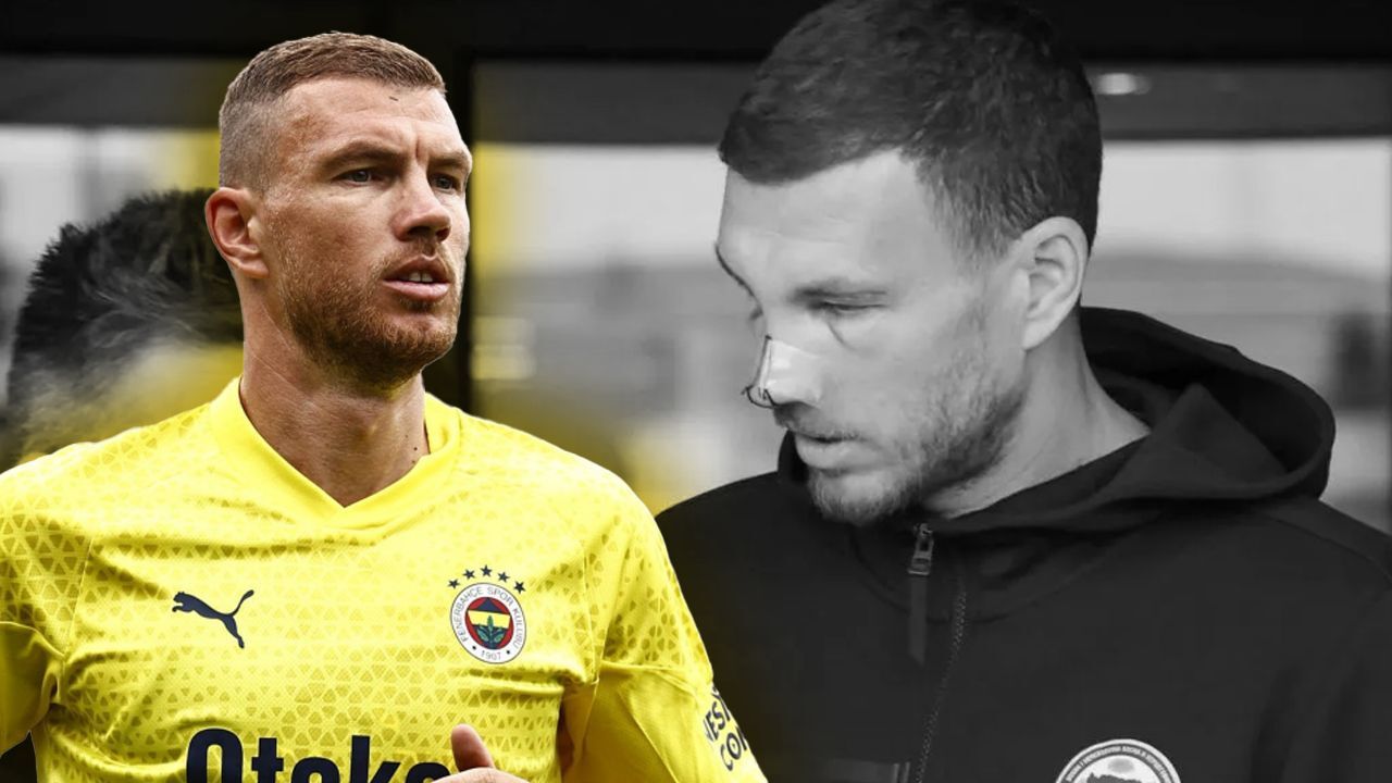 Dzeko&#039;dan üzen haber! Burnu kırıldı, gözleri morardı… İstanbul’a dönüş tarihi belli oldu