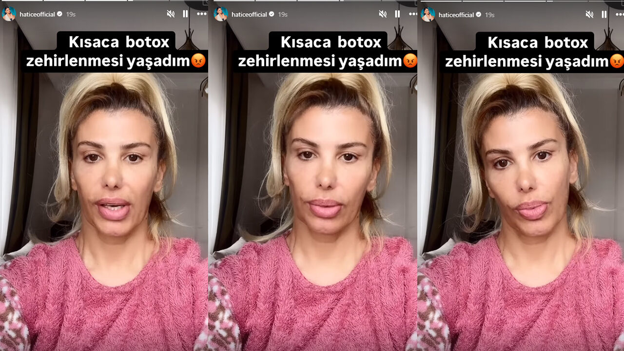 Ünlü şarkıcı Hatice'nin son hali korkuttu! Botoks mağduru oldu - 1. Resim