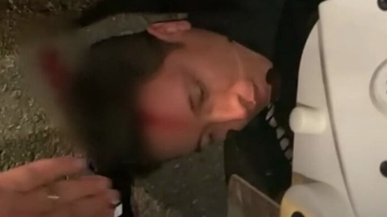 Saraçhane'de polise asitli saldırı! Eriyen üniformayı Bakan Yerlikaya paylaştı - 1. Resim