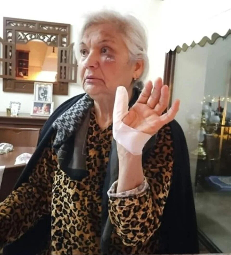 Demet Akalın'ın annesi kaza geçirdi! Apar topar soluğu yanında aldı Demet Akalın'ın annesi kaza geçirdi! Apar topar soluğu yanında aldı - 3. Resim