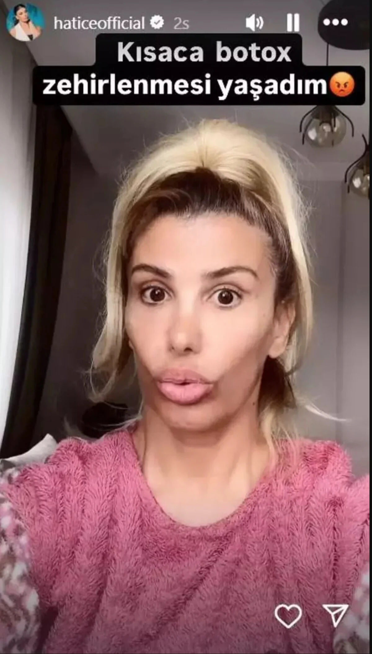 Botokstan zehirlenmişti! Şarkıcı Hatice'nin son hali korkuttu: Yaşadıklarını tek tek anlattı - 3. Resim