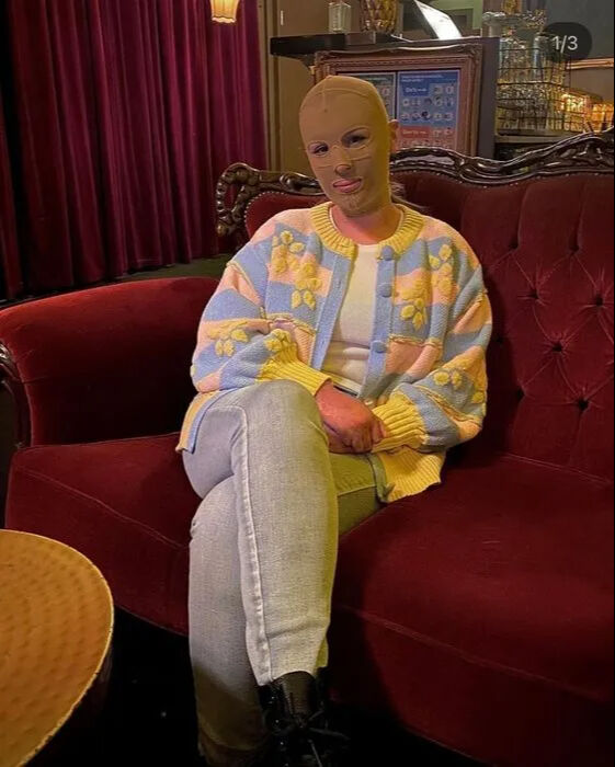 Tatil için gitmişti: Hem vücudu yandı, hem ailesini kaybetti - 2. Resim