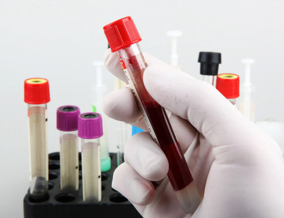 Kan gruplarının kanser türleriyle ilgisi ortaya çıktı: Bu gruplar özellikle dikkat etsin! - 1. Resim