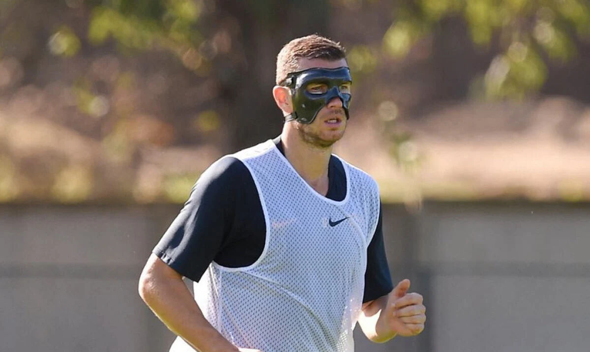 Dzeko neden maske takıyor, sakatlandı mı? Edin Dzeko sakatlık durumu açıklaması geldi! - 5. Resim