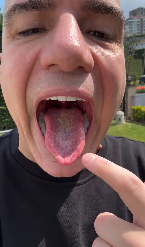 Apar topar ameliyata alınmıştı! Berdan Mardini'de oluşan o yaralar korkuttu - 3. Resim