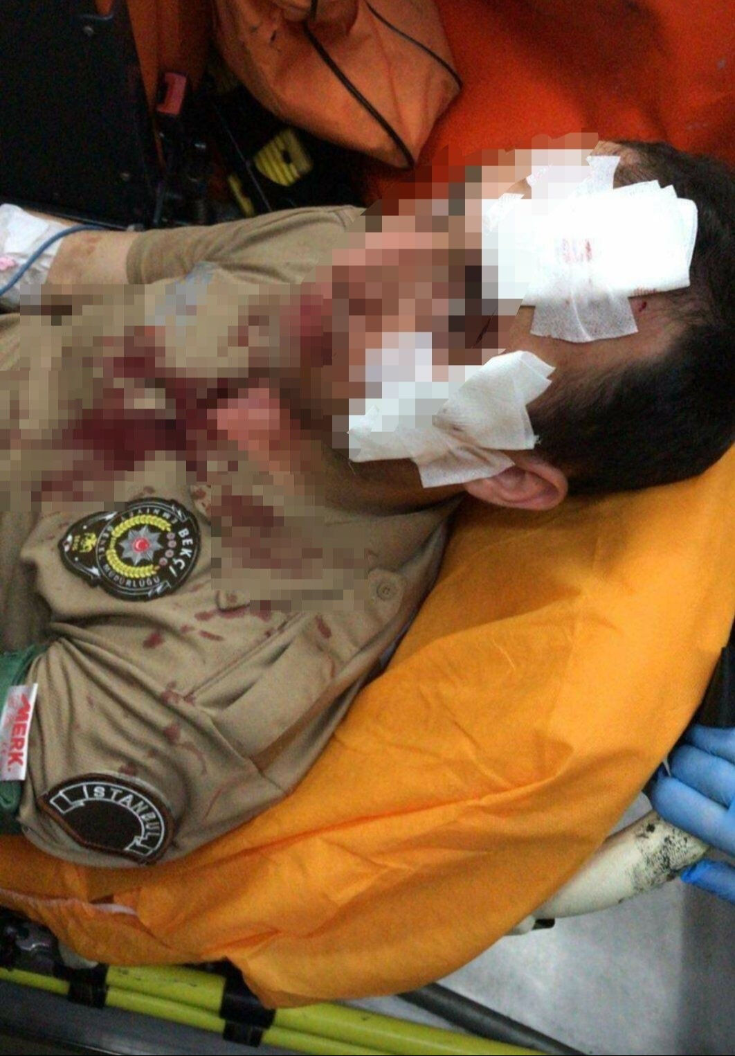 Bağcılar'da kimlik kontrolü kanlı bitmişti: Bekçiyi yüzünden vuran 4 şüpheli yakalandı - 1. Resim