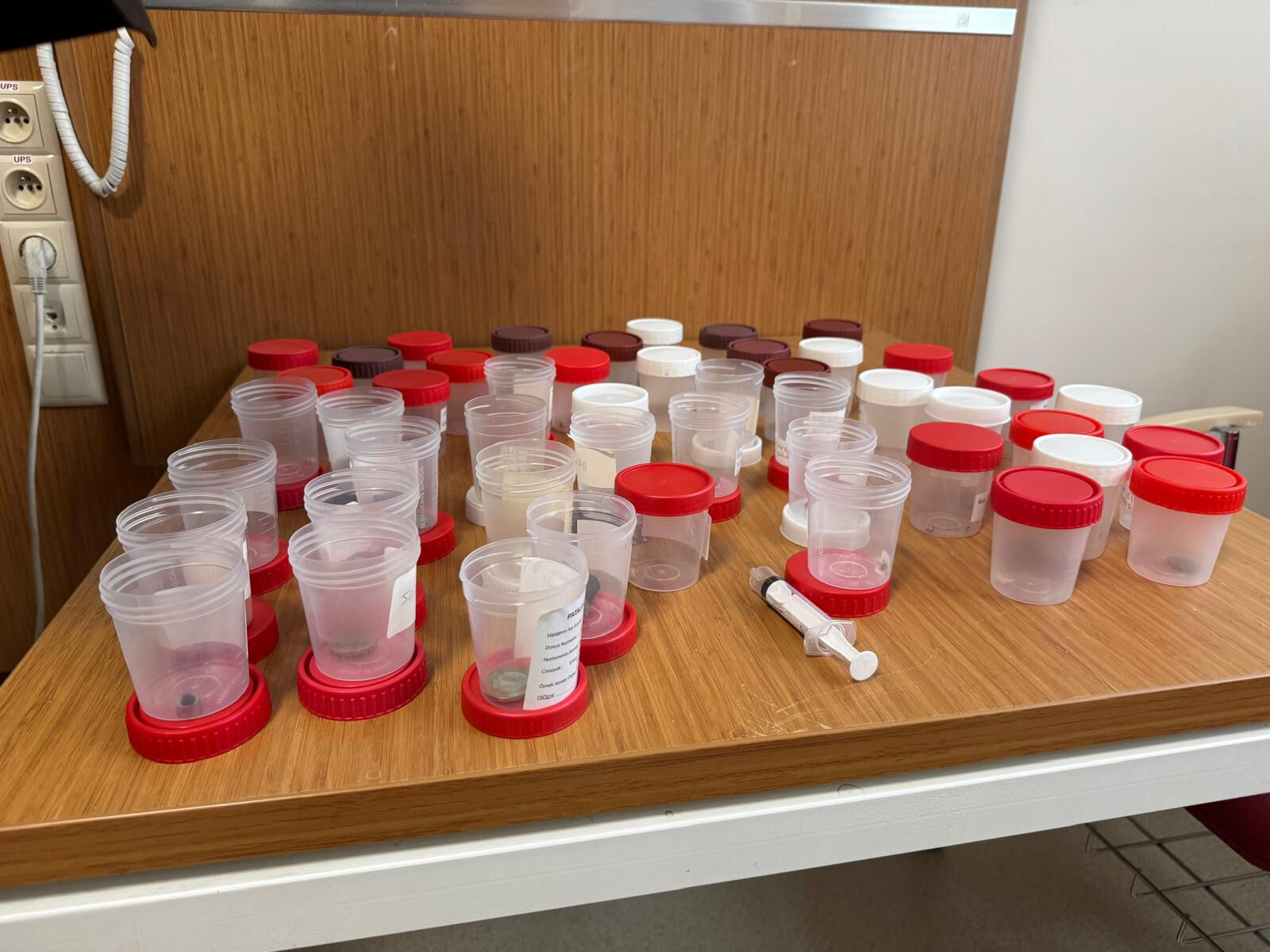 1,5 yaşındaki bebek faciayı yaşadı! Yemek borusundan çıkan şoke etti 1,5 yaşındaki bebek faciayı yaşadı! Yemek borusundan çıkan şoke etti - 1. Resim