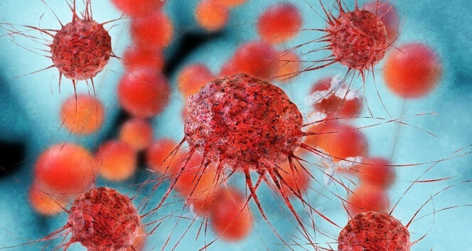 Korkunç artış! Yılda 14 milyon kişi kansere yakalanıyor - 4. Resim