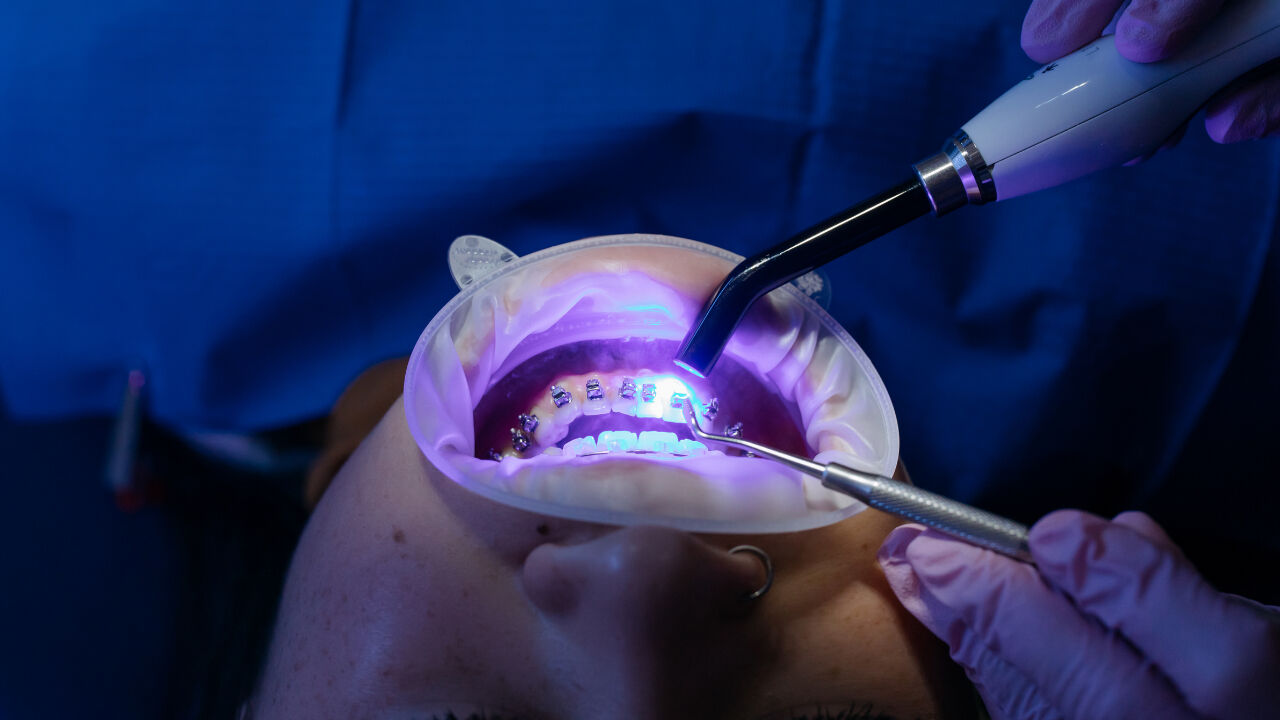 Diş sararması kaçınılmaz! Uzmanlar uyarıyor, bunlara dikkat etmiyorsanız beyaz dişlere veda edin - 4. Resim