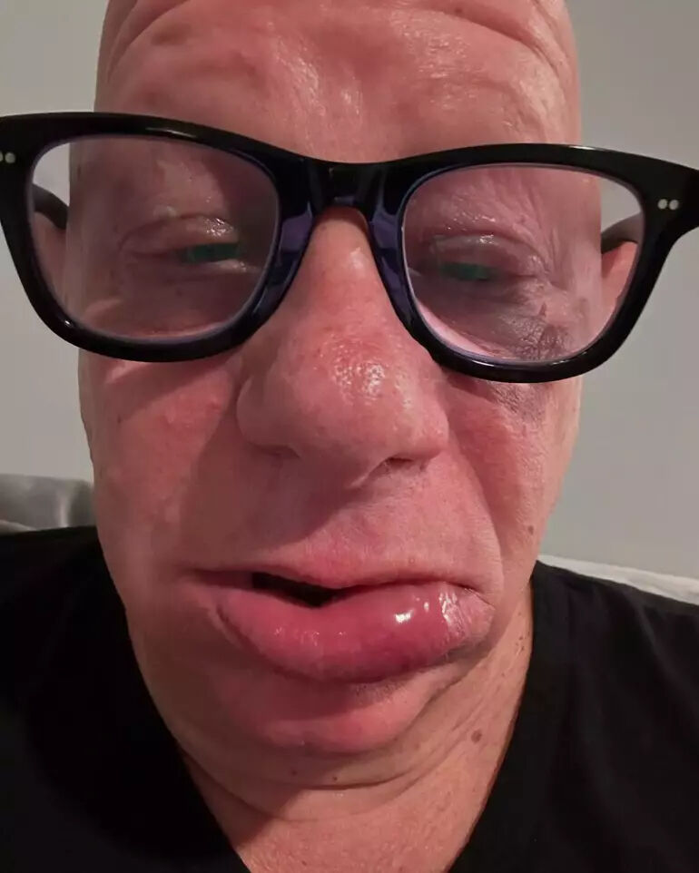 Ünlü komedyen yediği dondurma sonrası hayatının şokunu yaşadı! Görenler tanıyamadı - 3. Resim