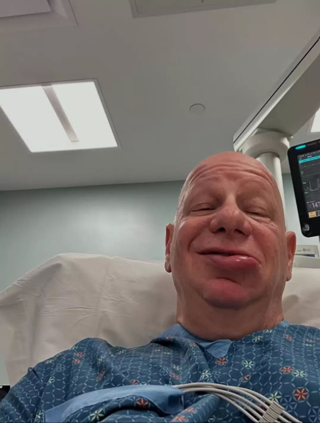 Ünlü komedyen yediği dondurma sonrası hayatının şokunu yaşadı! Görenler tanıyamadı - 2. Resim