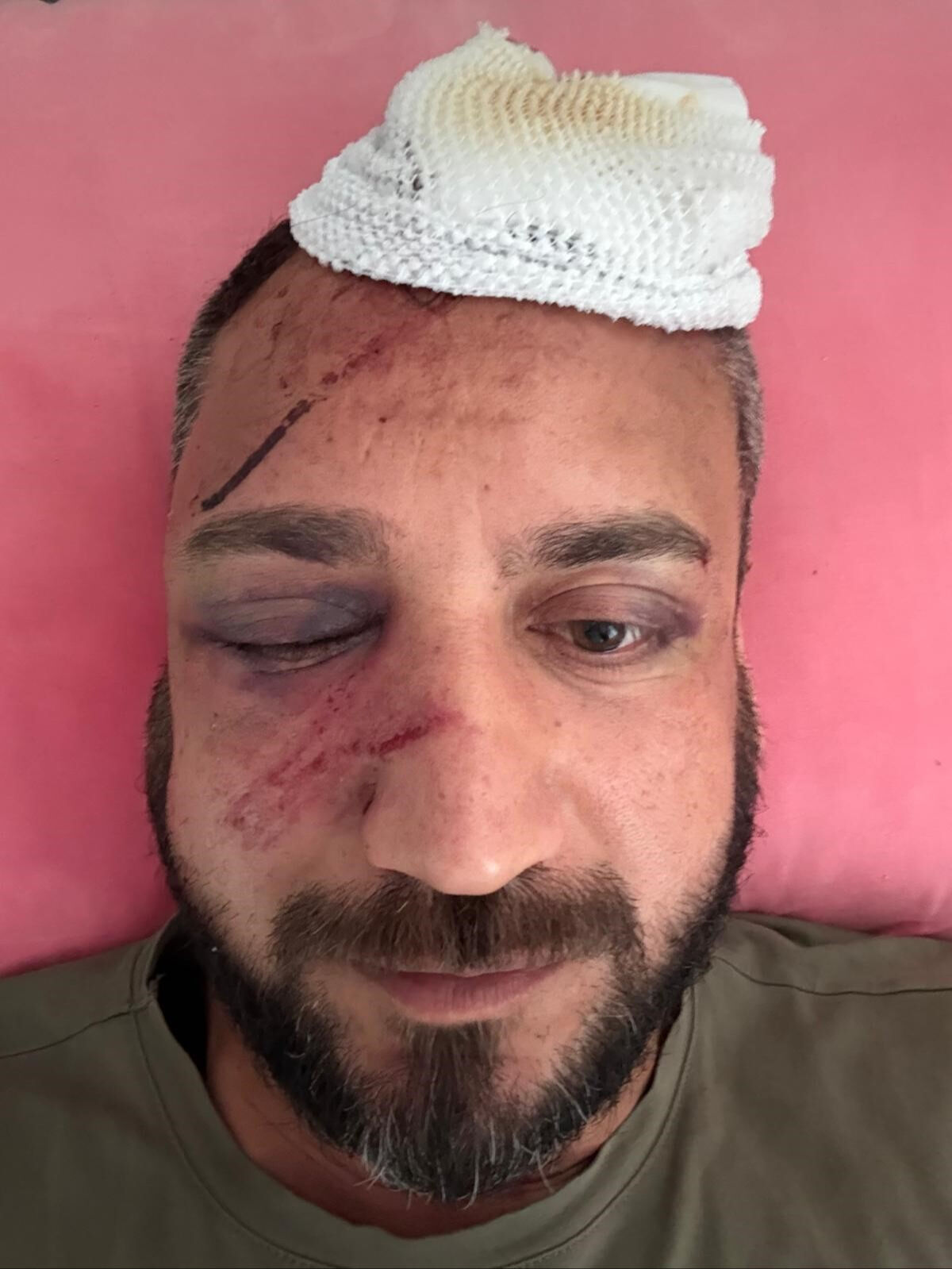 Parasını kaptırdığı eski sevgilisinin ailesi darbetti! Tanınmaz hale geldi Parasını kaptırdığı eski sevgilisinin ailesi darbetti! Tanınmaz hale geldi - 2. Resim