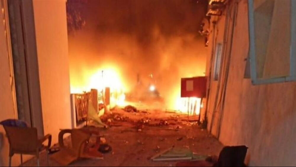 İsrail Baptist Hastanesi'ni küle çevirdi! Katliamın bilançosu büyüyor - 1. Resim