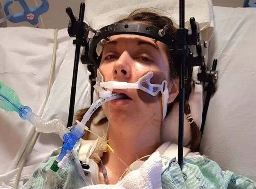 Beden eğitimi dersinde faciayı yaşadı! Kafatası omurgasından ayrıldı: 37 ameliyat geçirdi - 1. Resim