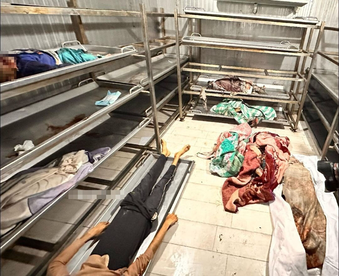 Gazze'de katliam sürüyor! İsrail sivillerin çadırlarını hedef aldı: Çok sayıda ölü ve yaralı var Gazze'de katliam sürüyor! İsrail sivillerin çadırlarını hedef aldı: Çok sayıda ölü ve yaralı var - 2. Resim