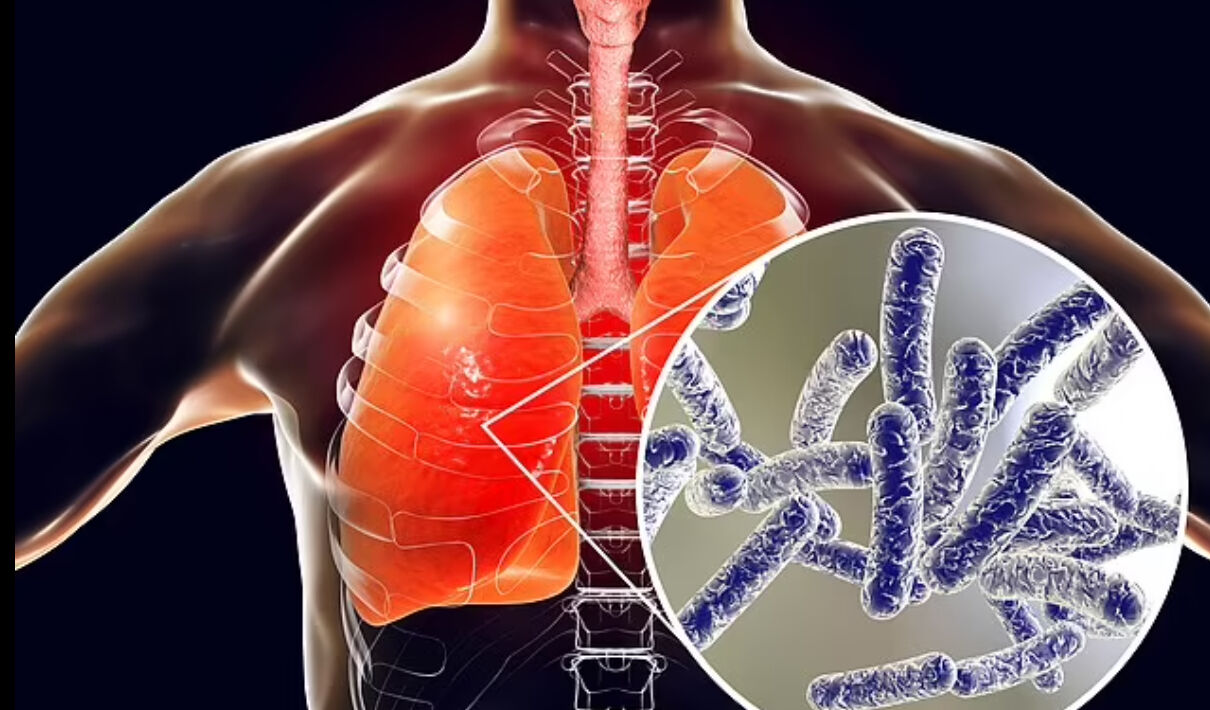 Ülkede Lejyoner alarmı! Yetkililer harekete geçti, yakalananlar felaketi yaşıyor - 1. Resim