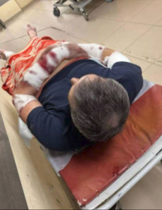 Başıboş köpek saldırısı! Hem saldırılan hem de tanık olan faciayı yaşadı Başıboş köpek saldırısı! Hem saldırılan hem de tanık olan faciayı yaşadı - 1. Resim