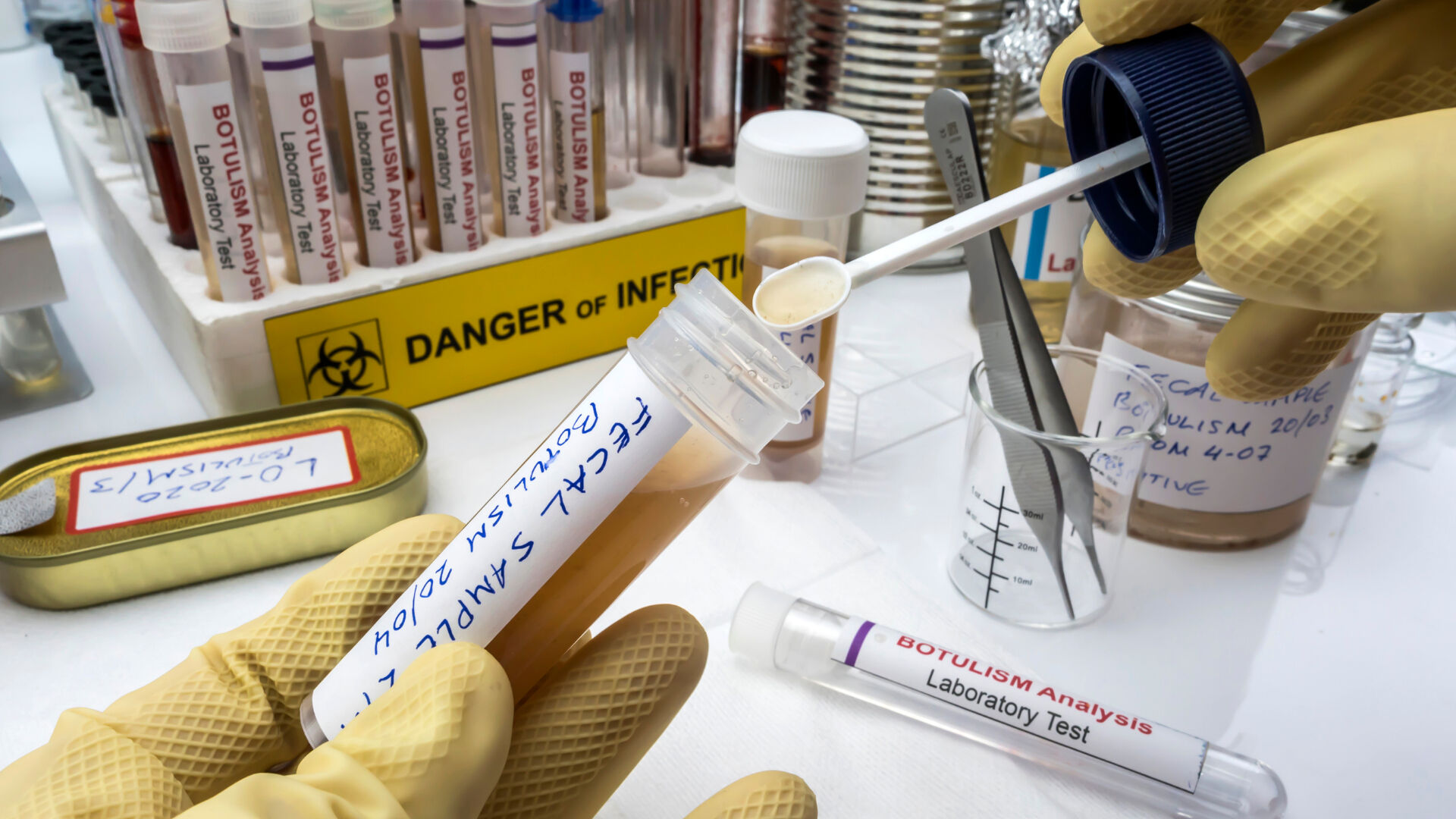 Ülkede acil durum ilan edildi! Humma hastalığından 34 ölüm - 1. Resim