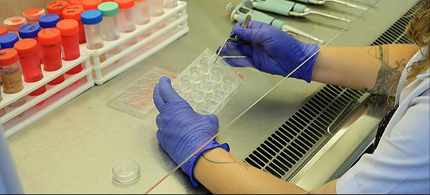 Anında demir seviyesini yükseltiyor, demir depolarını dolduruyor! Günde bir avuç yemek yeterli! Anında demir seviyesini yükseltiyor, demir depolarını dolduruyor! Günde bir avuç yemek yeterli! - 2. Resim