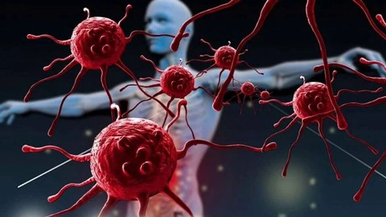 Sağlıklı sandığınız anda ortaya çıkıyor! 6 kanser türü endişe verici boyutlara ulaştı - 2. Resim