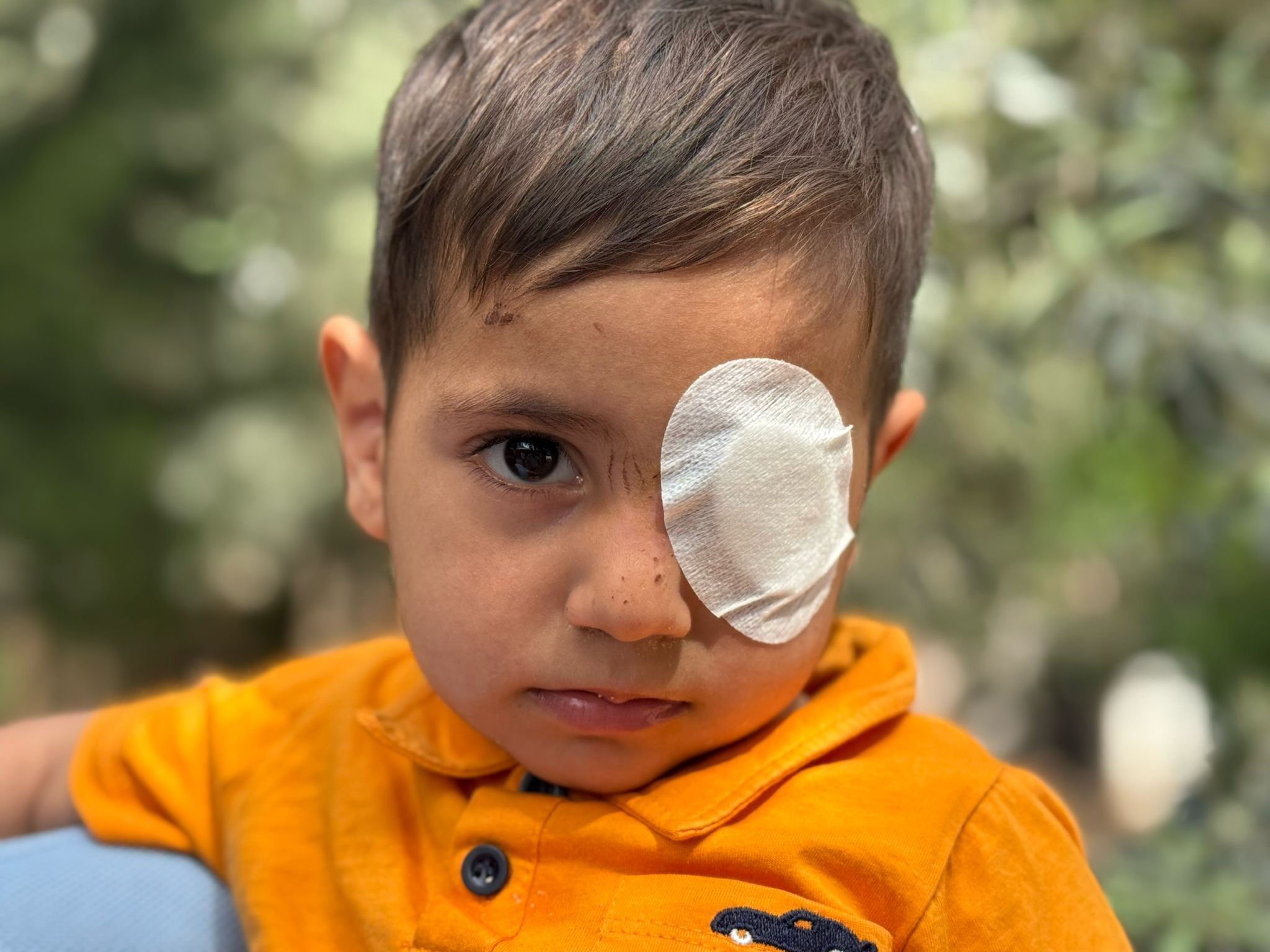 Bir babanın isyanı! Başıboş sokak köpekleri 3 yaşındaki çocuğu gözünden yaraladı - 1. Resim