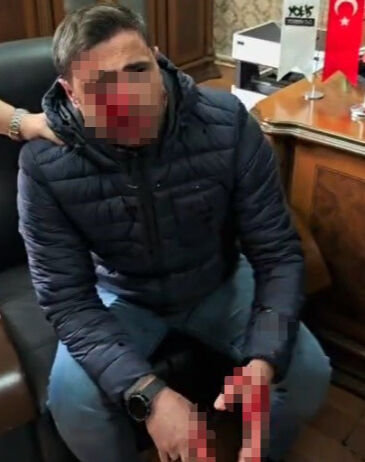 Korkunç olay! Okul basan veli öğretmeni yumrukladı Korkunç olay! Okul basan veli öğretmeni yumrukladı - 2. Resim