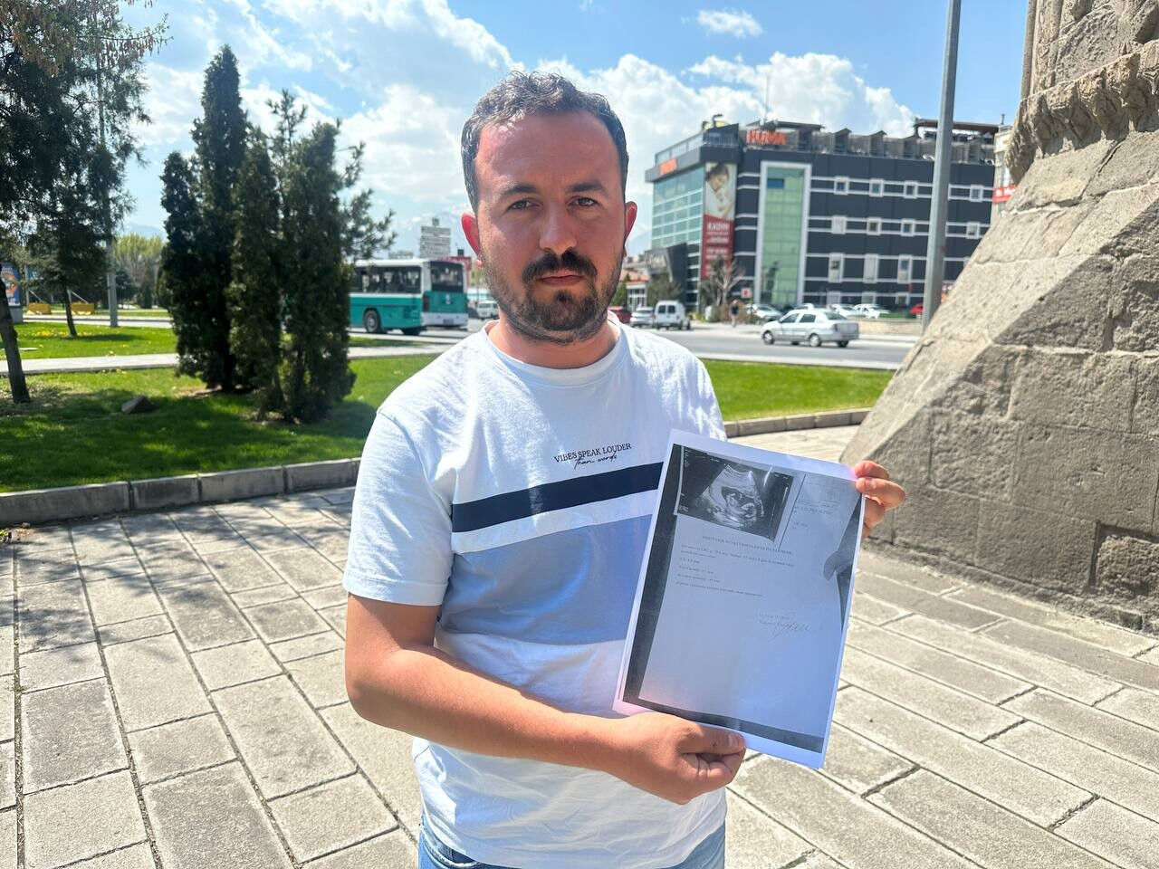 Kayseri’de aynı hastanede ikinci skandal! Yanlış tedavi can aldı Kayseri’de hastane skandalı! Yanlış tedavi can aldı - 2. Resim