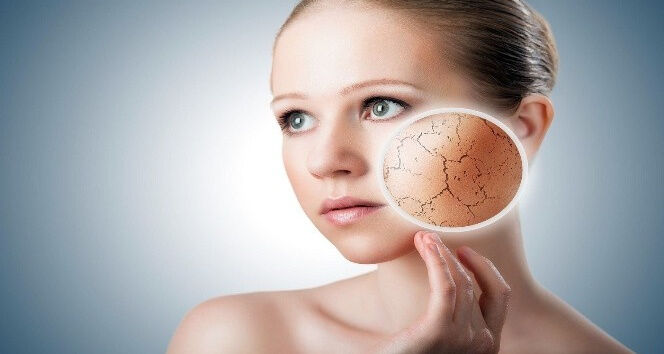 Uzmandan uyarı geldi! 'Y&uuml;zdeki bir kızarıklık' deyip ge&ccedil;meyin: Meğer... - 1. Resim