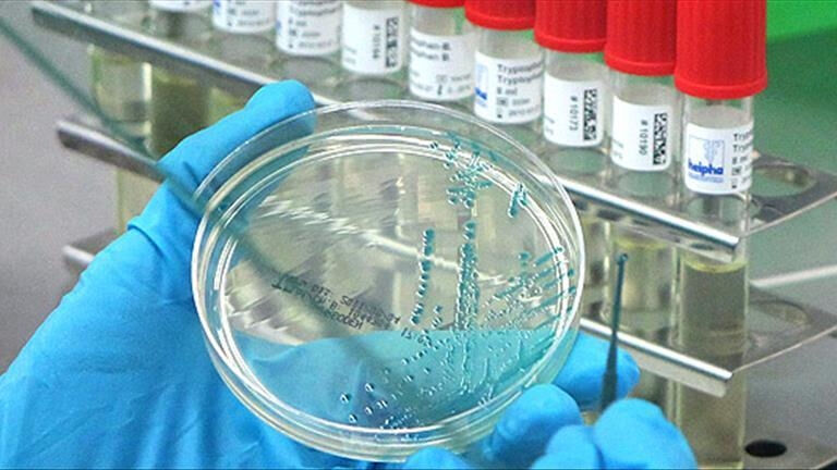 Covid'i öngören bilim insanı uyardı: Bir sonraki küresel salgın çoktan başlamış olabilir! Covid'i öngören bilim insanı uyardı: Bir sonraki küresel salgın çoktan başlamış olabilir! - 1. Resim