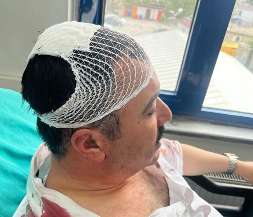 Şekerlikle belediye başkan yardımcısını yaralamıştı! YRP'li isim tutuklandı Şekerlikle belediye başkan yardımcısını yaralamıştı! YRP'li isim tutuklandı - 2. Resim