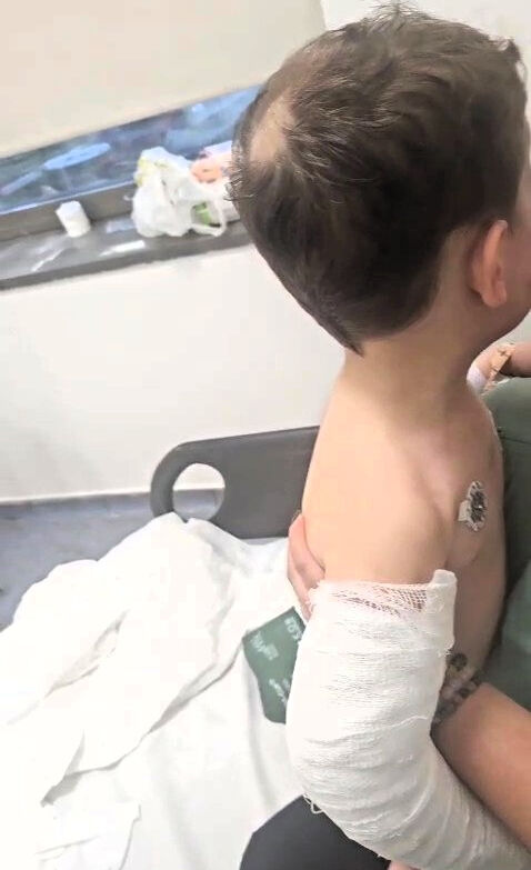 Denizli'de 2 yaşındaki bebeğe kan donduran eziyet! Bakanlık hemen devreye girdi - 1. Resim