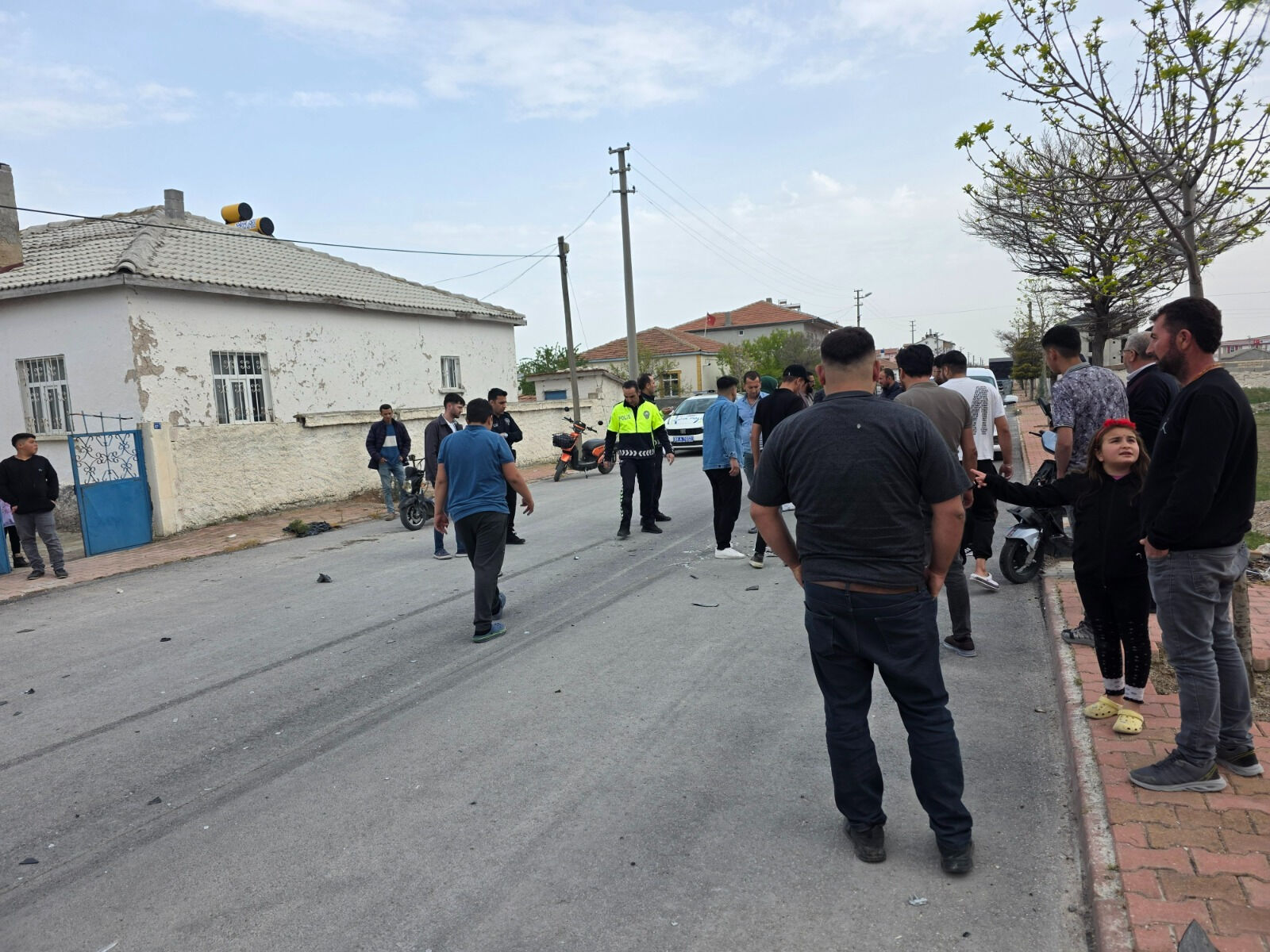 Feci kazada gözü çıktı! Hastaneden kahreden haber geldi - 1. Resim