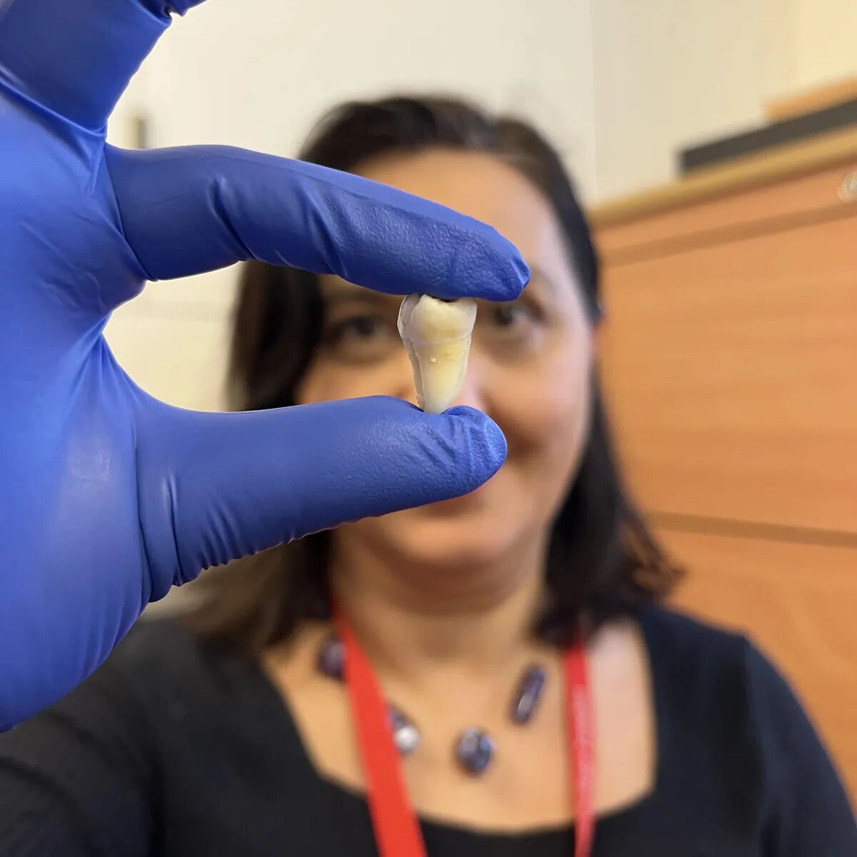 Artık dolgu yaptırmayacaksınız: Yeni teknoloji dişlerin kendini onarmasını sağlıyor! Artık dolgu yaptırmayacaksınız: Yeni teknoloji dişlerin kendini onarmasını sağlıyor! - 1. Resim