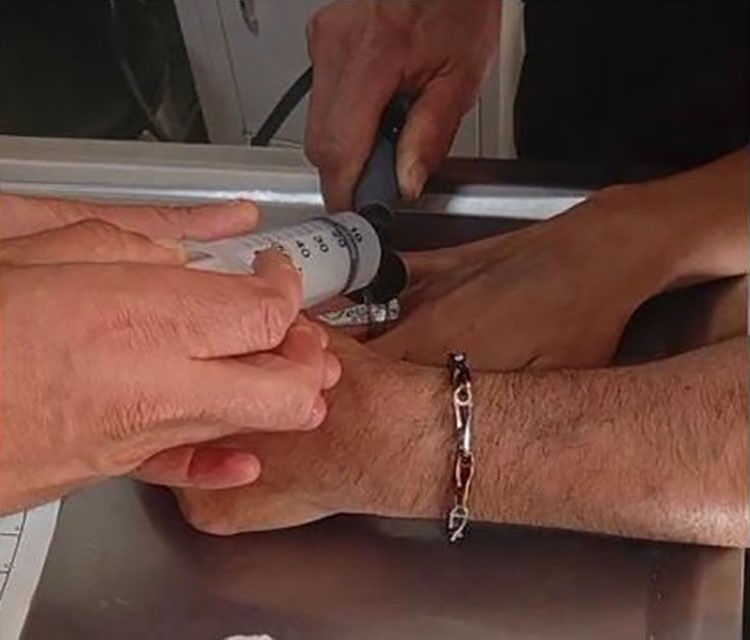 Parmağındakini gören ekipler seferber oldu! Denemedikleri yol kalmadı.... Parmağındakini gören ekipler seferber oldu! Denemedikleri yol kalmadı.... - 2. Resim