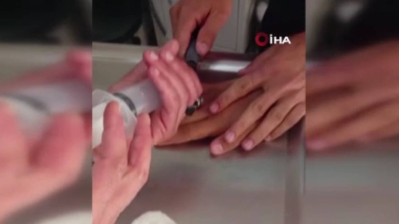 Parmağındakini gören ekipler seferber oldu! Denemedikleri yol kalmadı.... Parmağındakini gören ekipler seferber oldu! Denemedikleri yol kalmadı.... - 1. Resim